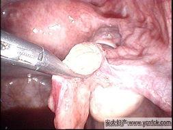 人流术后吃瓜,如何科学饮食恢复健康？瓜类食物的神奇功效